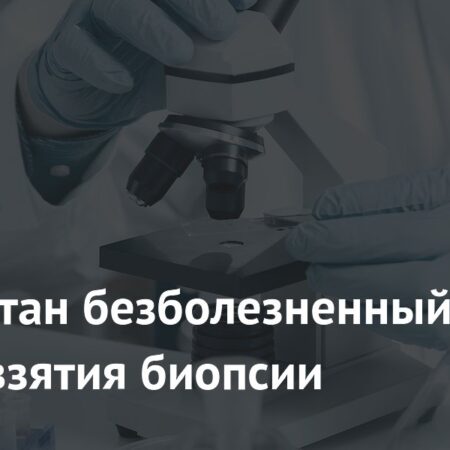 Разработан безболезненный способ взятия биопсии