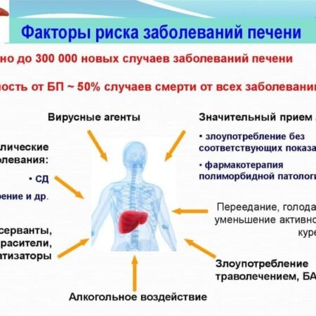 Основные факторы, способствующие развитию рака печени: результаты нового анализа