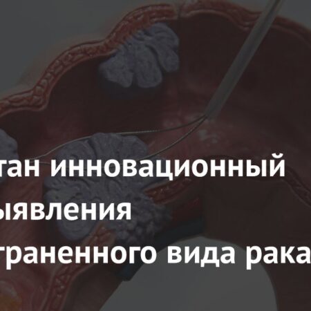 Инновационный метод ранней диагностики колоректального рака