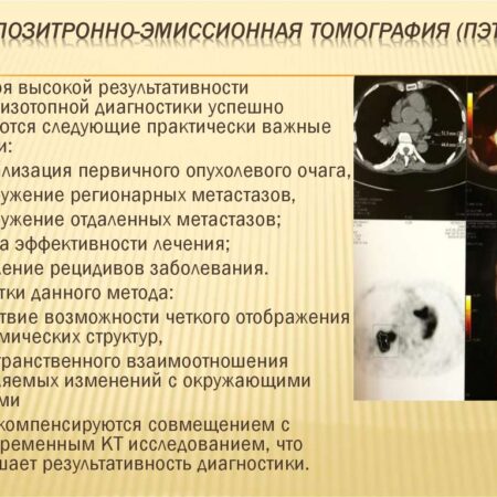 Неожиданный эффект препаратов GLP-1: влияние на результаты онкологических ПЭТ-КТ