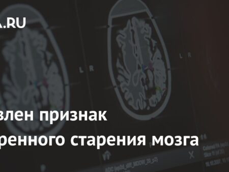 Выявлен биомаркер ускоренного старения мозга