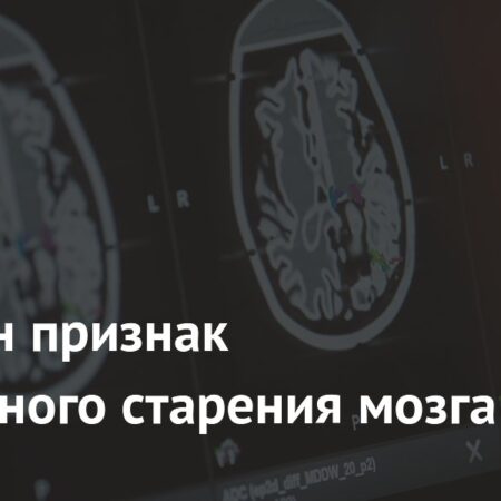 Выявлен биомаркер ускоренного старения мозга