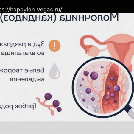6 причин хронической молочницы: биопленка, дисбиоз и эстрогены