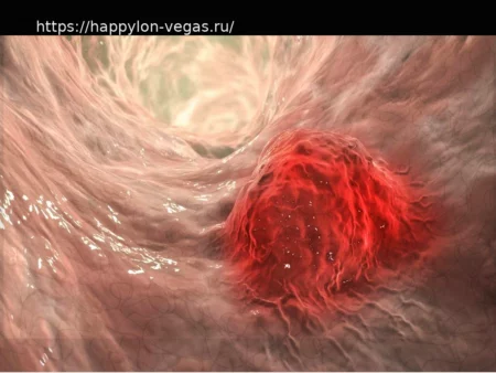 Обнаружен биомаркер для определения пациентов с раком толстой кишки, которые ответят на иммунотерапию