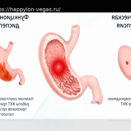 Функциональная диспепсия: как отличить от органических заболеваний
