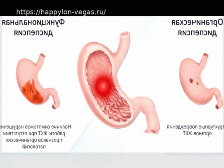 Функциональная диспепсия: как отличить от органических заболеваний