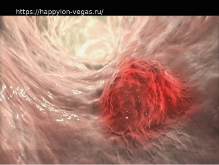 Обнаружен биомаркер для расширения применения иммунотерапии при раке толстой кишки